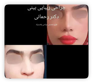 نمونه کار دکتر امیرحسین رحمانی