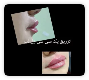 نمونه کار دکتر امیرحسین رحمانی