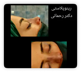 نمونه کار دکتر امیرحسین رحمانی