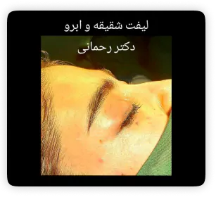نمونه کار دکتر امیرحسین رحمانی