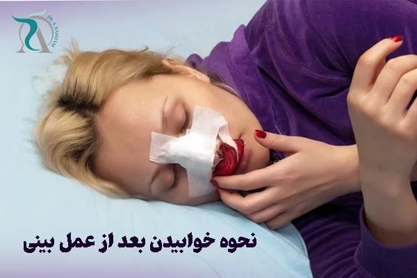 بعد عمل بینی چطور بخوابیم؟