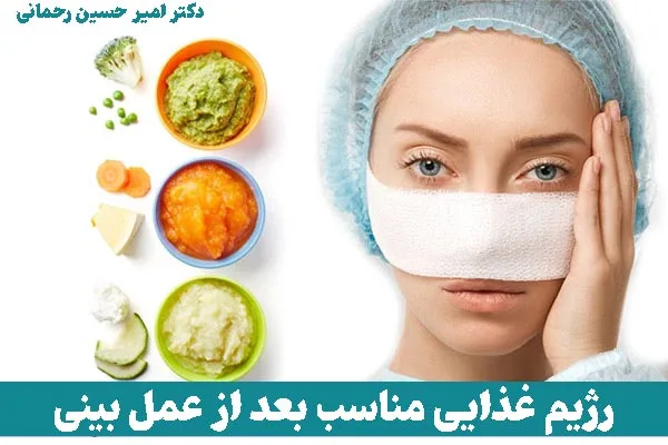 بعد از عمل بینی چی بخوریم؟