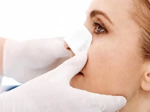 نحوه صحیحی چسب زدن بعد عمل بینی