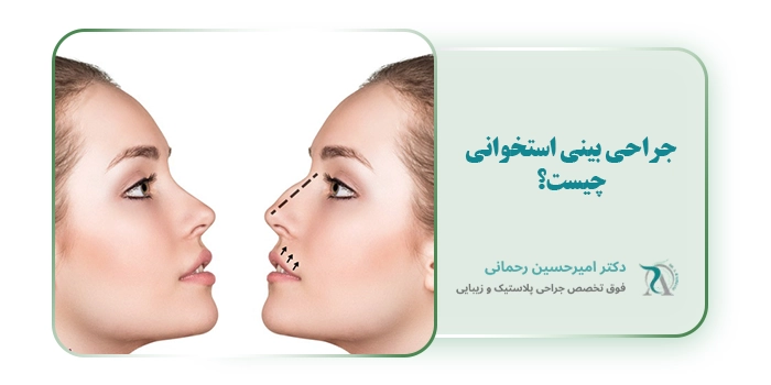 جراحی بینی استخوانی چیست؟