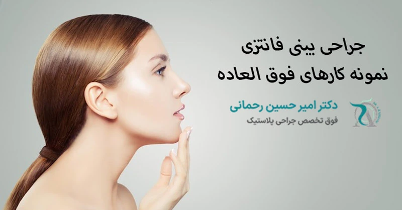 عمل بینی فانتزی برای چه کسانی مناسب است؟