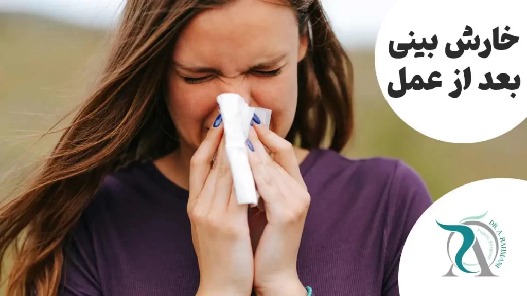 آیا خارش بینی بعد از عمل طبیعی است؟