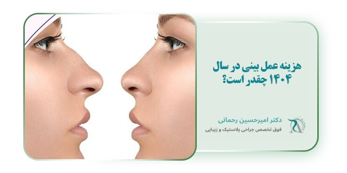 هزینه عمل بینی در سال 1404 چقدر است؟