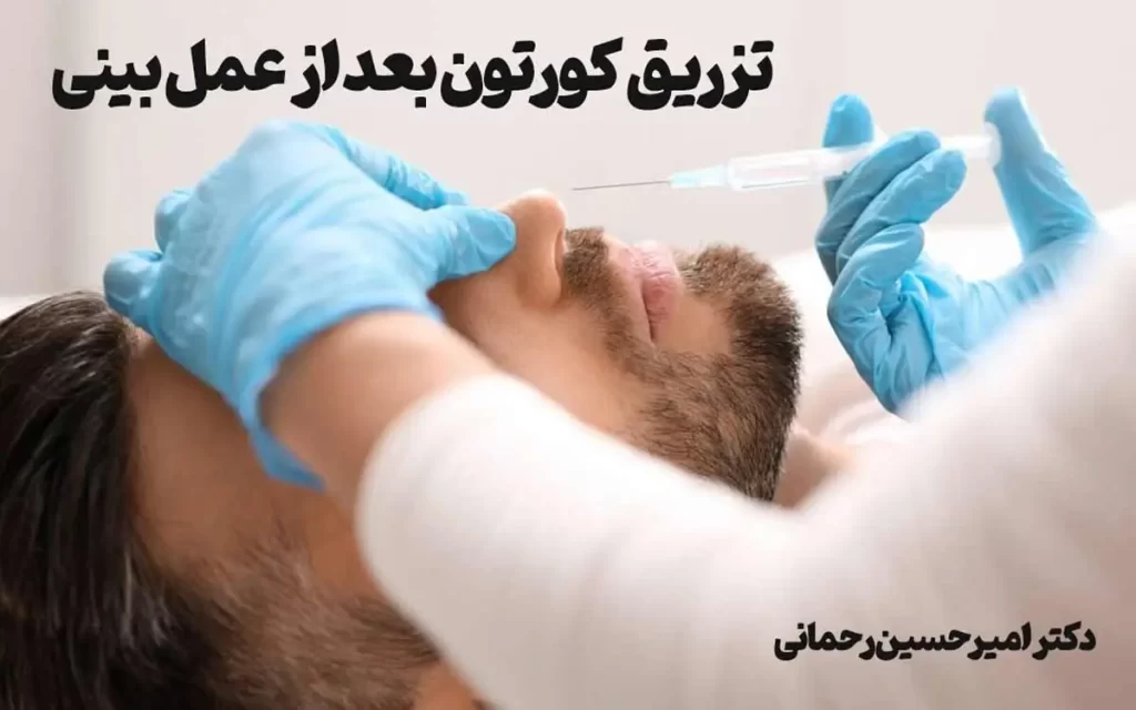 کورتون به بینی بعد عمل بزنم؟
