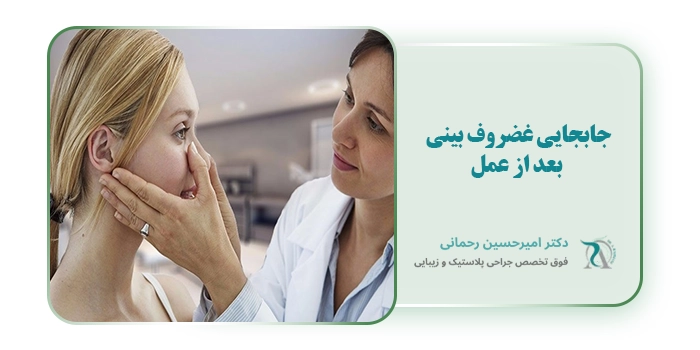 جابجایی غضروف بینی بعد از عمل
