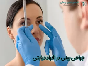 جراحی بینی در افراد دیابتی