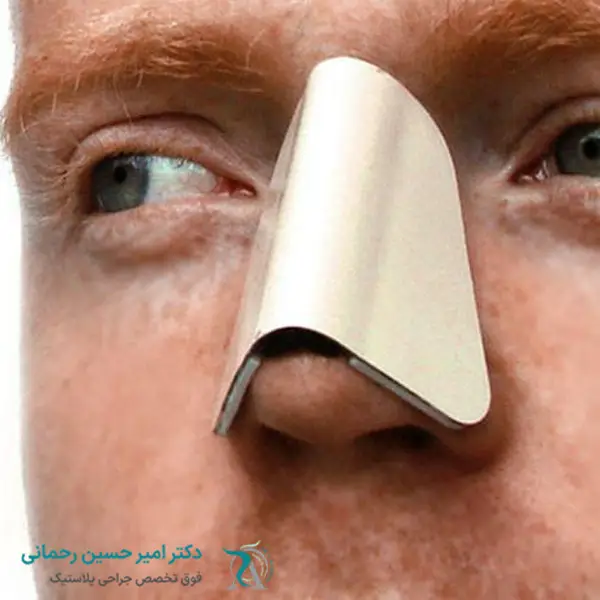 مدت زمان استفاده از اسپلینت بینی