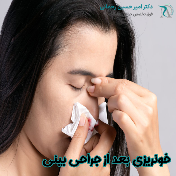خونریزی بعد از رینوپلاستی