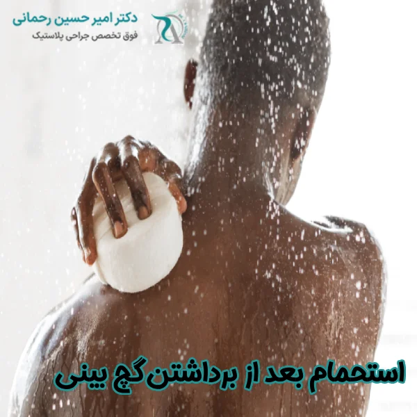استحمام بعد از برداشتن گچ بینی