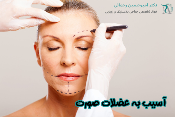 آسیب به عضلات صورت