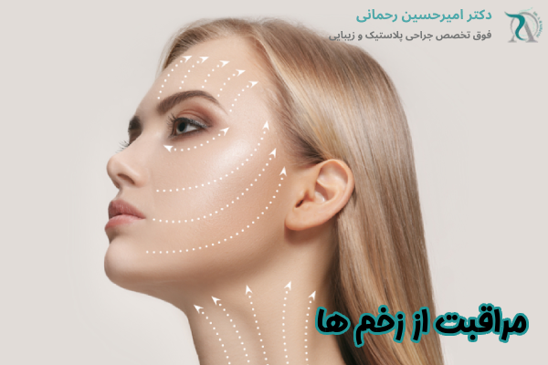 مراقبت از بخیهها بعد از جراحی لیفت صورت