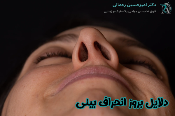 دلایل بروز انحراف بینی