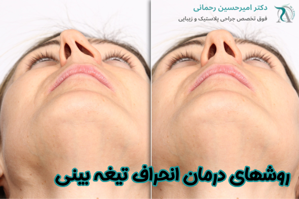 روشهای درمان انحراف تیغه بینی