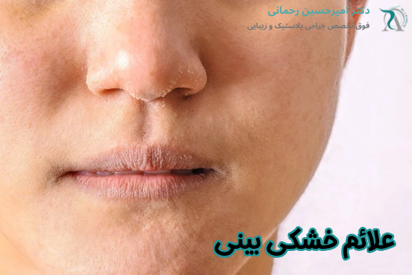 علائم خشکی بینی