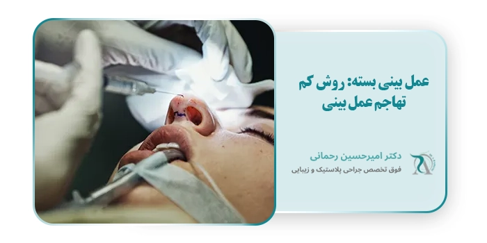 عمل بینی بسته: روش کم تهاجم عمل بینی