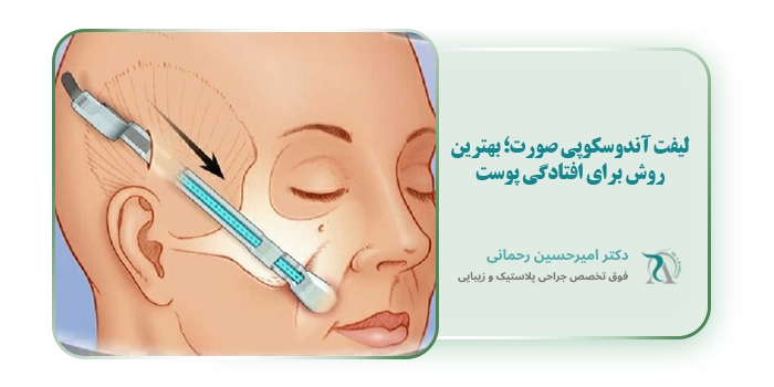 لیفت آندوسکوپی صورت؛ بهترین روش برای افتادگی پوست